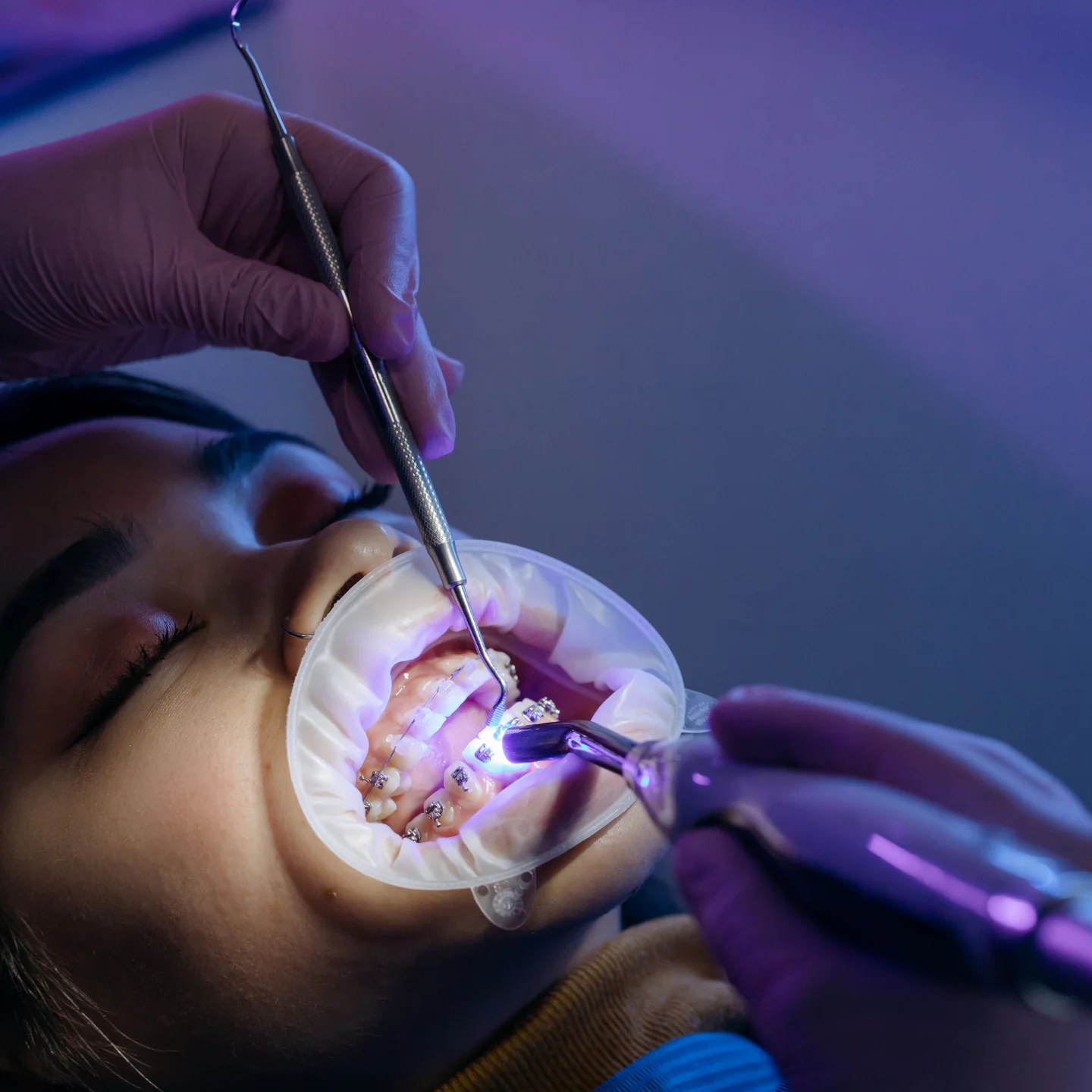 Orthodontist For Adults 1 Orthodontist For Adults Orthodontist for adults