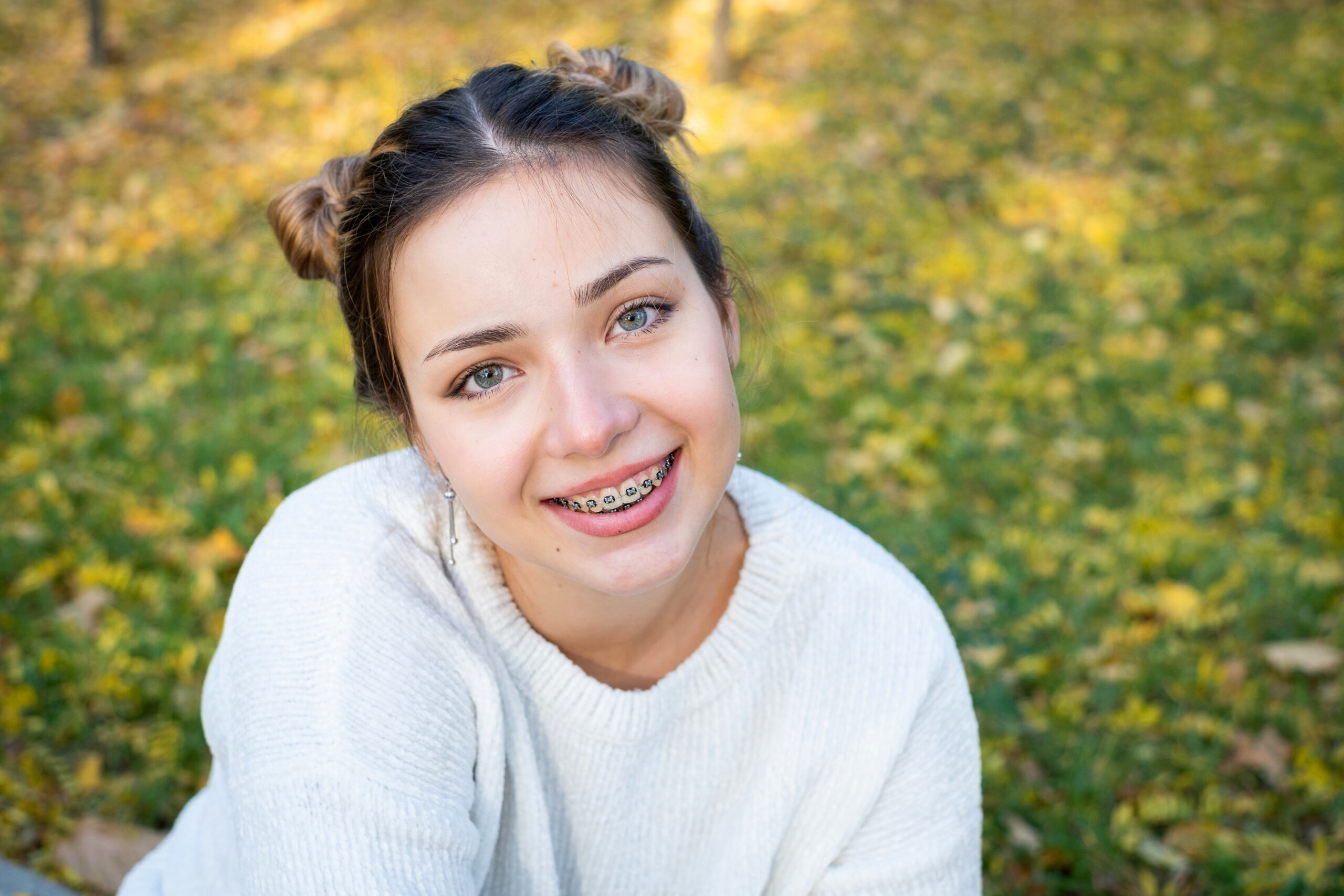 Braces for teens